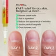 thumbnail image 2 of Beso de felicidad | 1 fragancia crujiente | Lápiz para cutículas con aceite para uñas con vitamina E y jojoba, fortalecedor de uñas, tratamiento para el crecimiento de las uñas, para pelar las uñas fr, 2 of 9