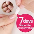 thumbnail image 4 of 3/1pcs Fungal Nail Treatment Pen Anti Fungal Onychomycosis Paronychia Nail Care Liquid, 4 of 5