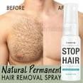 thumbnail image 3 of WUWULE Permanent Hair Removal Spray Stop Hair Growth Inhibitor Remover For Men & Women, 3 of 8
