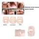 thumbnail image 4 of Herramienta para corregir uñas encarnadas Clip elástico para enderezar uñas Correctores de silicona para uñas de los pies, 4 of 8