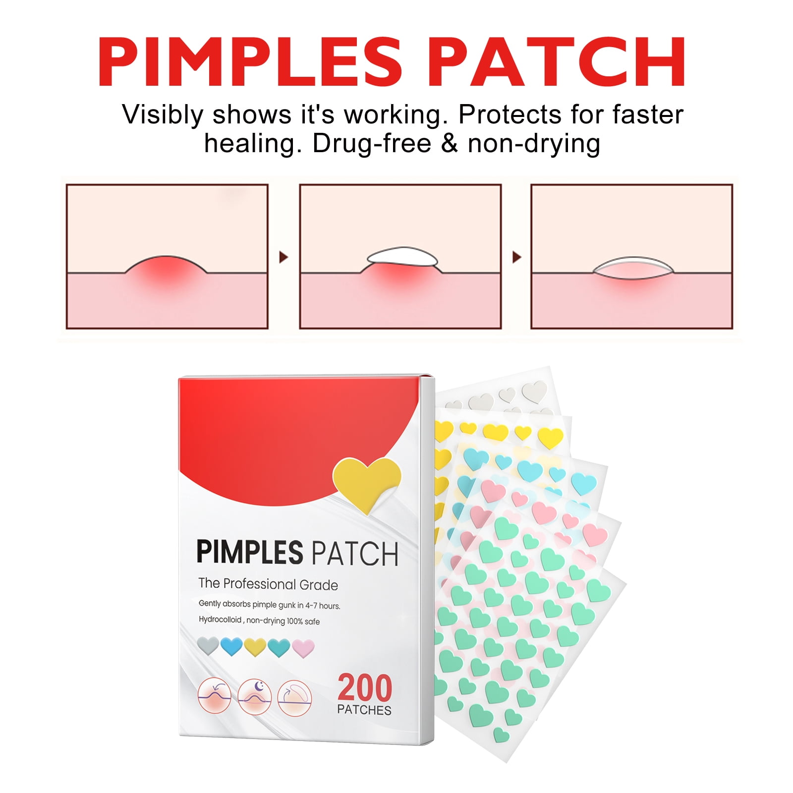 Alvantor Pimple Patches for Face with Tea Tree, Hydrocolloid Acne, Hurt Zit Covers, 200 Count