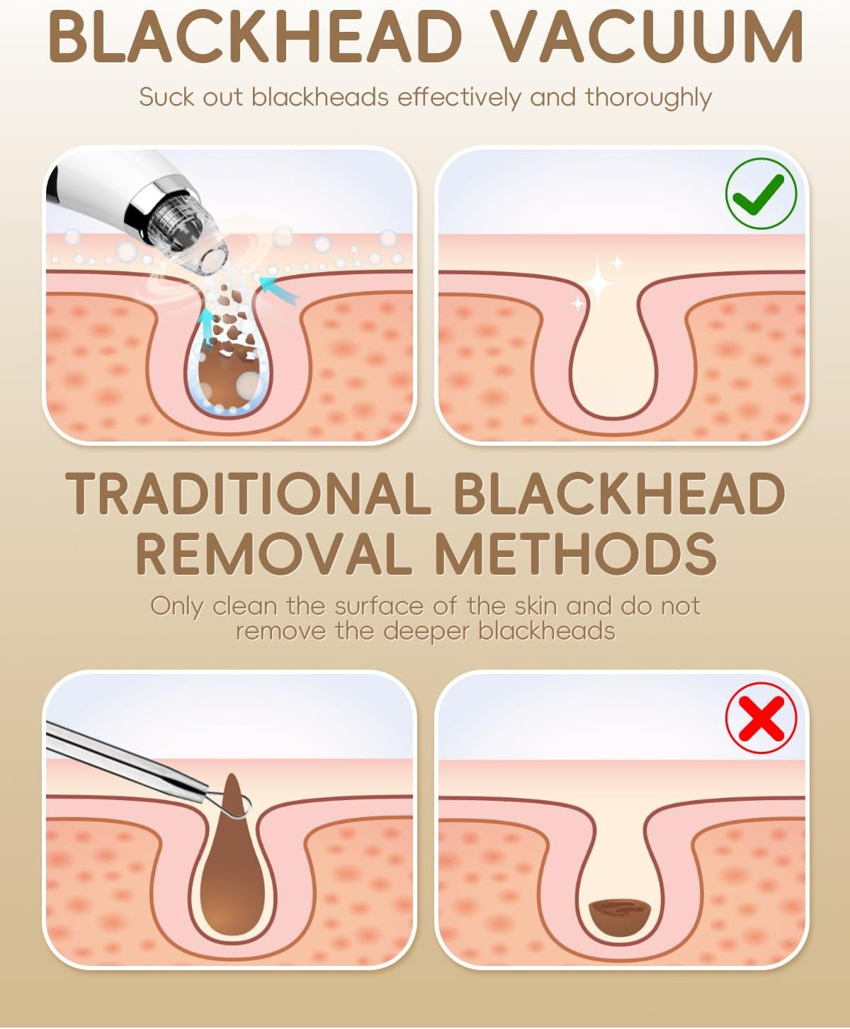 Facial Pore Blackhead Remover Vacuum - Face Cleaner and Blackhead Extractor with 3 Adjustable Suction Levels, 5Replaceable Tips - Pore Vacuum Kit for Women&Men (White)