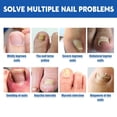 thumbnail image 3 of Parche de uñas 20 piezas, parche de reparación de uñas transpirable e indoloro, reduce el dolor para uso diario, 3 of 4