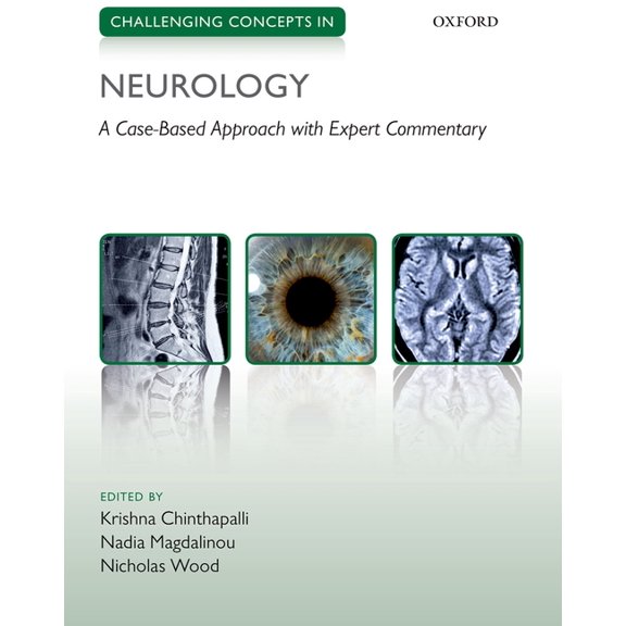 Challenging Cases Challenging Concepts in Neurology: Cases with Expert Commentary, (Paperback)