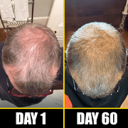Pete & Pedro BOOST Hair & Beard Growth Strengthening Serum With Biotin & Rosemary, 2 oz