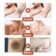 thumbnail image 5 of Acantho Clear Improve Skin Spray, Fade Black Spots Repair Elbow Knee Joints Black Glow White Skin 30ml, 5 of 9
