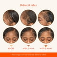 thumbnail image 6 of RED by Kiss Growth MD Hair Growth Scalp Serum, Biotin, Niacinamide, Panthenol, Rosemary Oil Infused, Made with 100% Natural Ingredients, USDA Certified Organic Oils, Non-GMO, 6 of 8