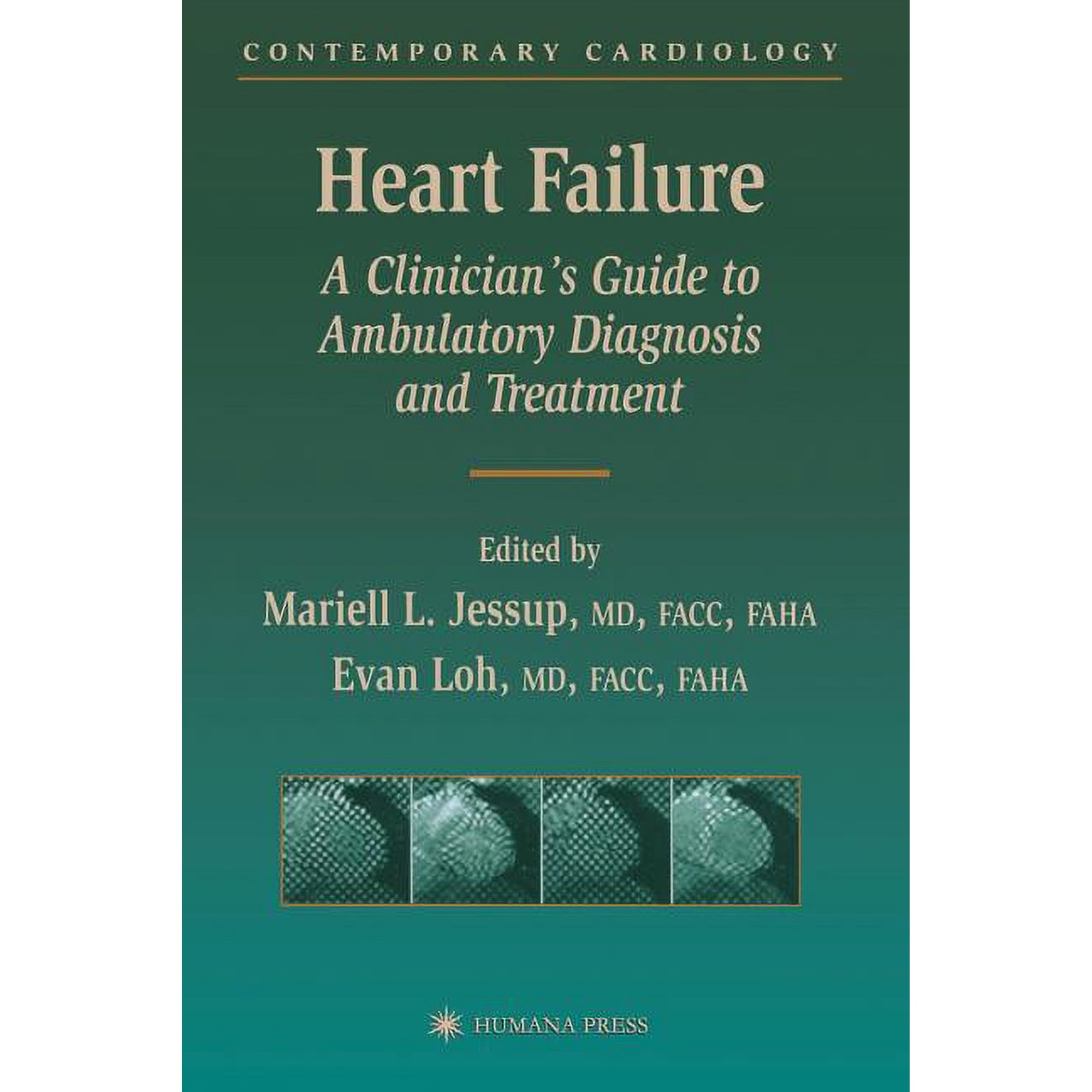 Contemporary Cardiology Heart Failure: A Clinician's Guide to Ambulatory Diagnosis and Treatment, (Paperback)