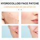 thumbnail image 5 of Jumpingount Parche para el acné Facial, pegatinas universales para la frente, cuidado de la piel, belleza, eliminación autoadhesiva, parches Tratamientos faciales, 5 of 6
