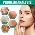 Finally! The Easy Fix For Big Blackheads You'Ve Been Waiting For - qi6jlc1