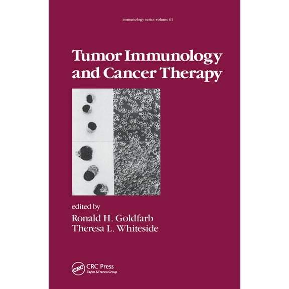 Immunology Tumor Immunology and Cancer Therapy, (Paperback)