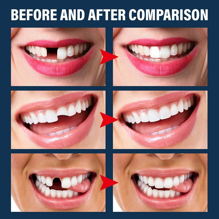 Mojoyce Temporary Tooth Filling Repair False Teeth Solid Glue Dental Repair  Beads 