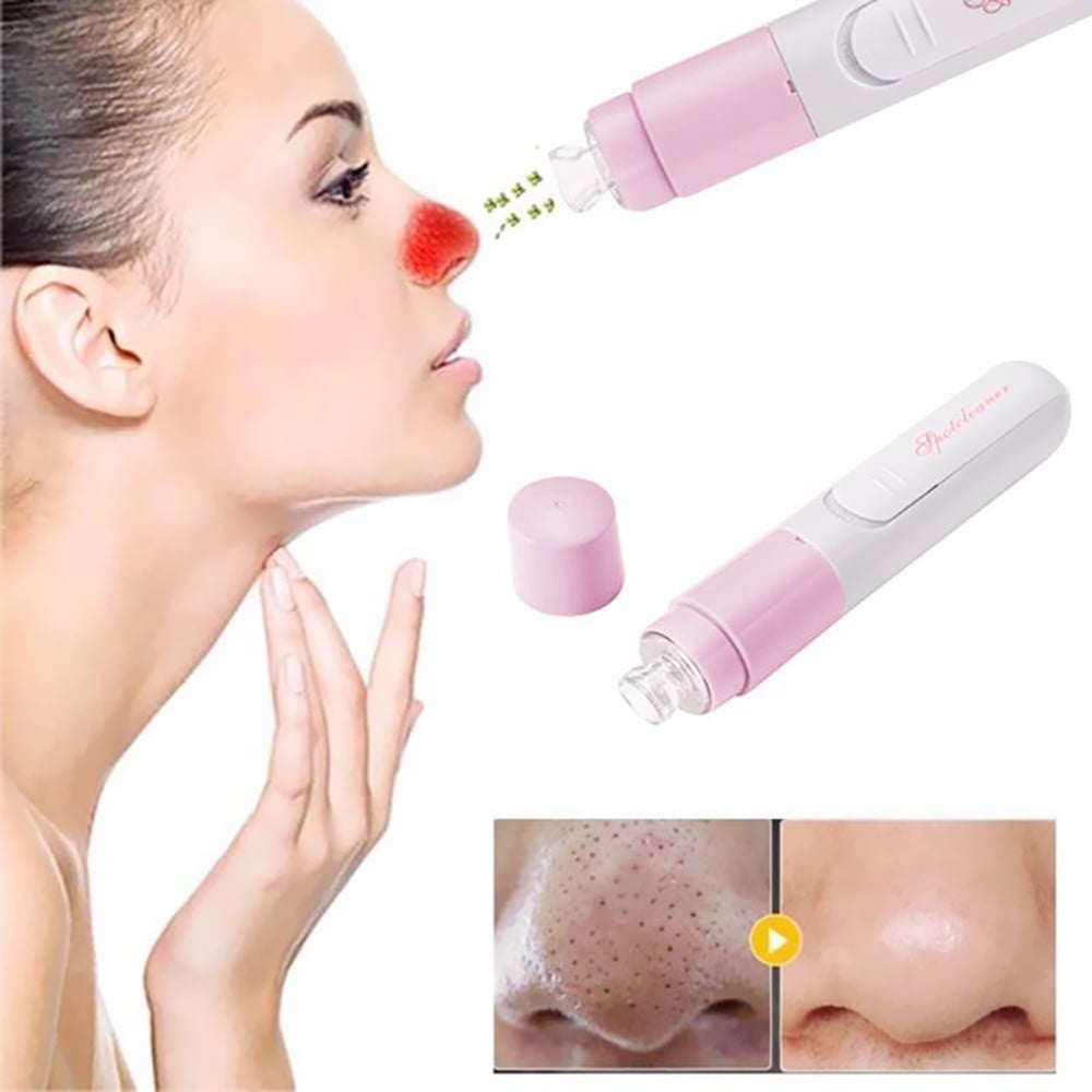 pore cleansing device