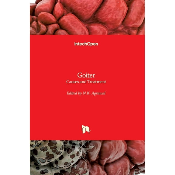 Goiter