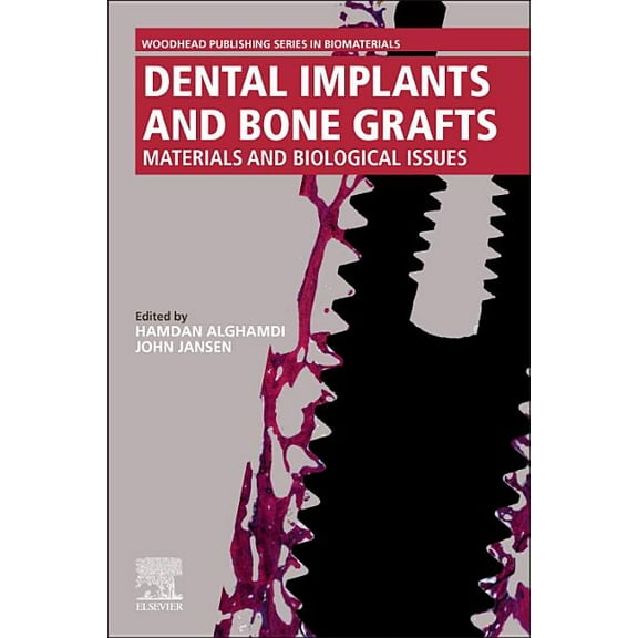Dental Implants and Bone Grafts: Materials and Biological Issues, (Paperback)