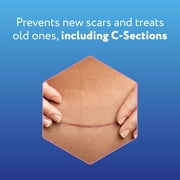 ScarAway Advanced Skincare Silicone Scar Sheets for C-Section, Reusable Sheets (1.5” x 7”) for Hypertrophic and Keloid Scars from C-Section & Other Surgeries, 4 Sheets