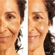 thumbnail image 3 of Serum Tree of Life con niacinamida y vitamina B3, 60 ml, paquete de 2, 3 of 8