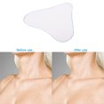 thumbnail image 2 of Almohadilla para el pecho antiarrugas + almohadilla para el cuello Parche de eliminación transparente de silicona Piel TFixol Almohadilla antiarrugas, 2 of 7