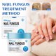 thumbnail image 4 of Teissuly Nail Repair Cream For Repairing Gray Nails, Brightening And Thickening Nails, Hand And Foot Nails, Moisturizing And Caring Cream Teissuly WER202401271577, 4 of 9