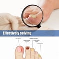thumbnail image 2 of IBeaLee nail polish antibacterial liquid, nail polish powder, nail polish fungus, nail polish antibacterial agent, 2 of 5