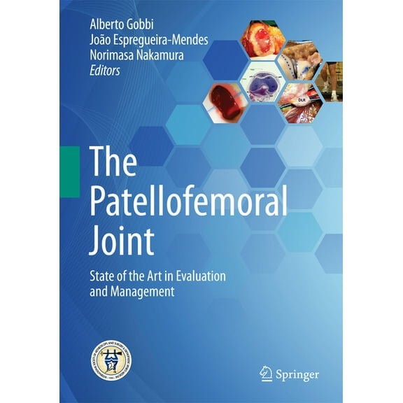 The Patellofemoral Joint: State of the Art in Evaluation and Management, (Hardcover)