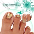 thumbnail image 4 of Kerassentials Toenail Fungus Oil Kerasentials Nail , Kerassentials Healthy Skin,Kerasentials Nail 60ml Buy 2 Save 10%, 4 of 4