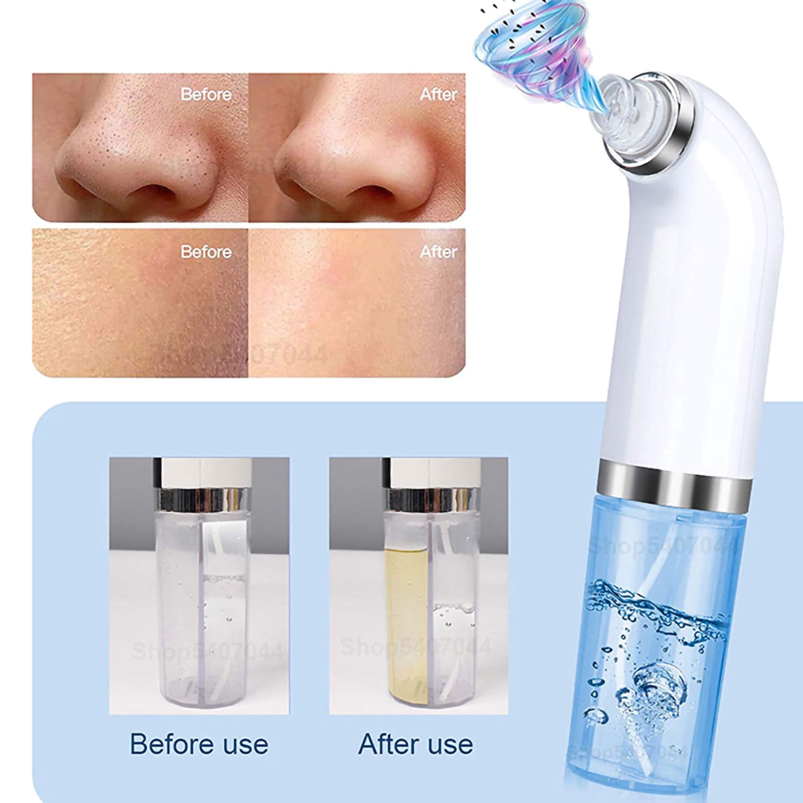 Blackhead Remover Pore Vacuum, with 6 Suction Heads Replaceable, Facial Cleaner Micro Bubble Beauty Instrument Electric Strong Suction Comedone Extractor Tool for Acne Removal Blackhead Sucker, White
