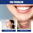 thumbnail image 4 of DPTALR Jaw Adjustment Clamp, Solution To Tooth Andjaw Alignment Issues, 4 of 9