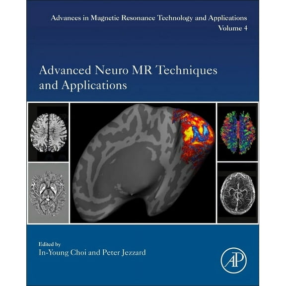 Advances in Magnetic Resonance Technolog Advanced Neuro MR Techniques and Applications: Volume 4, Book 4, (Paperback)