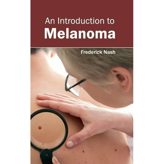 Introduction to Melanoma, (Hardcover)