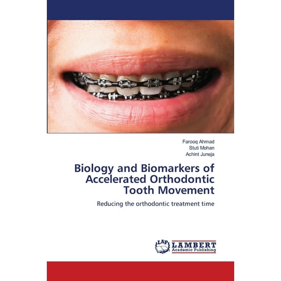 Biology and Biomarkers of Accelerated Orthodontic Tooth Movement, (Paperback)
