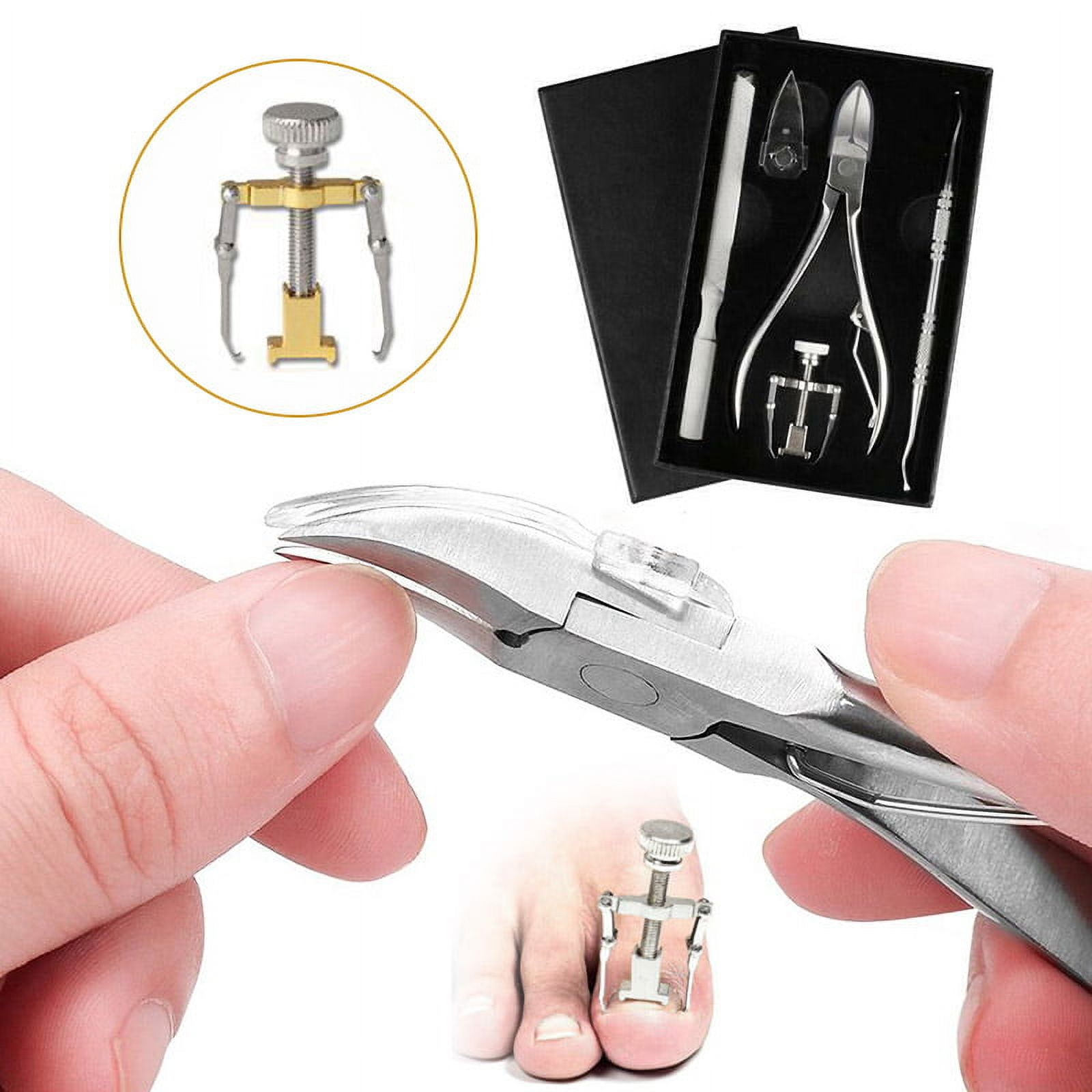 Ingrown Toenail Treatment Kit with Tools Nail Togo Ubuy