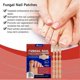 thumbnail image 5 of Natural Toenail-fungus Patch For Thick Nails, Quick Absorption Nail Strengthening Stickers, Nails Care Supplies, 5 of 5