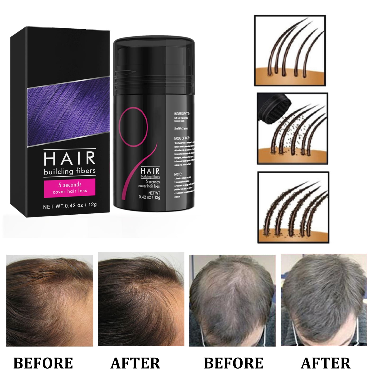 Alvantor Dark Brown Hair Building Fibers Powder for Thinning Hair, 0.42 oz - Instant Volume & Concealment for Men & Women