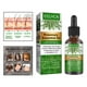 thumbnail image 1 of Aceite esencial de , con gotero 30 ml Acondicionador Aromaterapia para estimular el del cabello Mejora la circulación Brillo shamjiam Aceite esencial para el crecimiento del cabello, 1 of 9