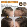 thumbnail image 3 of Biotin Dense Hair Series Deep Cleansing And Moisturizing Scalp Anti-Drop Solid Hair Dense Hair Care Shampoo Series, 3 of 5