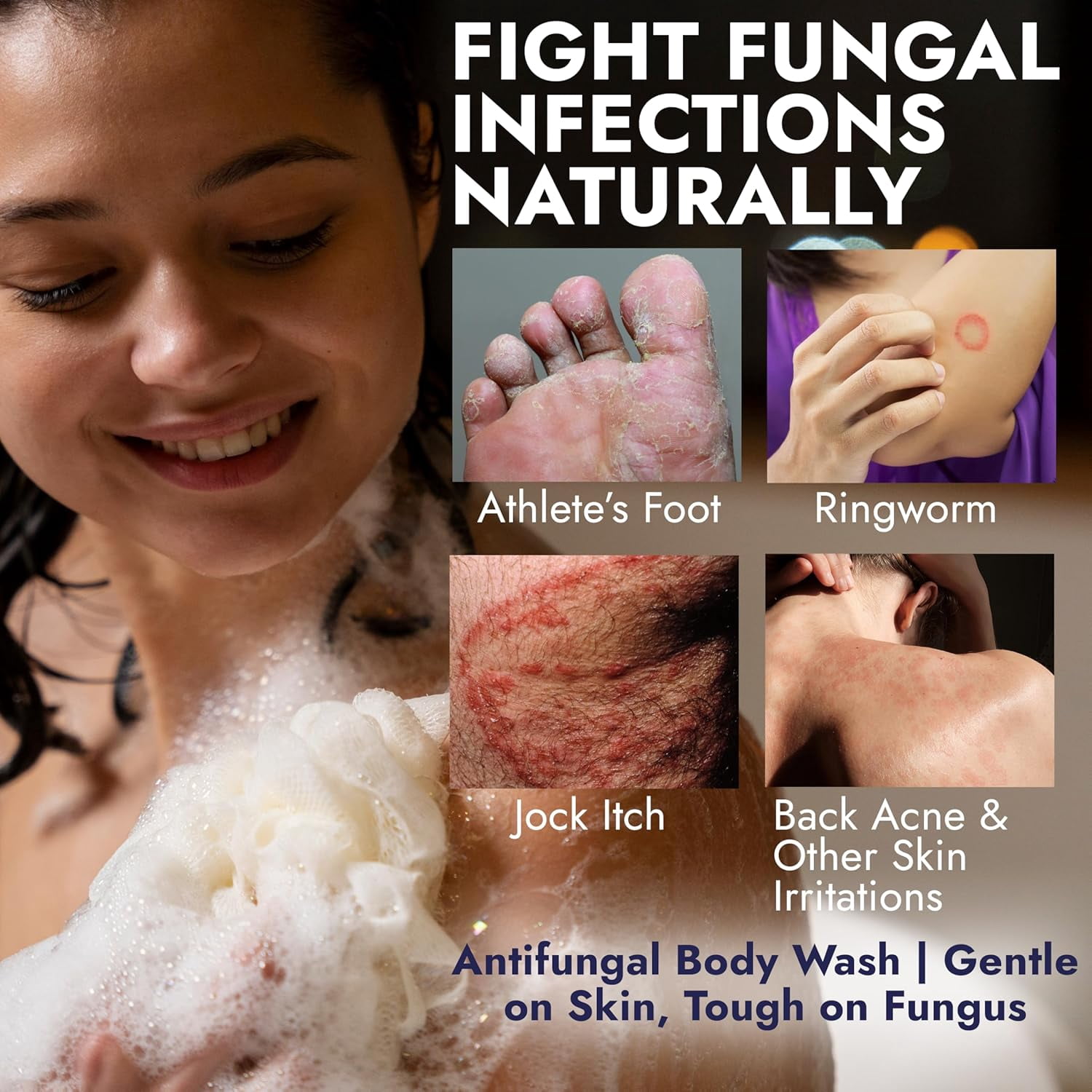 Antifungal Body Wash | Antifungal Soap with 1% Tolnaftate | Medicated Jock Itch Treatment for Ringworm & Athlete’s Foot | Cooling Effect Menthol Body Wash | Includes Scrubber 16.9 Fl oz