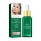 thumbnail image 1 of Acne Moisturizing Pore Tightening Acne Facial Skin Care Products,17ML, 1 of 5