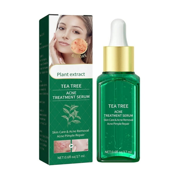 Acne Moisturizing Pore Tightening Acne Facial Skin Care Products,17ML