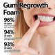 thumbnail image 4 of New Gum Regrowth Foam, Gum Treatment Foam, Anti Inflammatory, Gum Tissue Regeneration And Repair, Gum Care Foam Mousse, 4 of 5