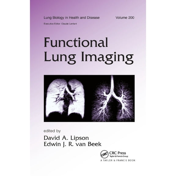 Functional Lung Imaging, (Paperback)
