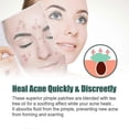 thumbnail image 5 of EELHOE 112 Patches Colorful Acne Patch Acne Removal Stickers Pimple Remover Tool Face Skin Care for Day Night Us, 5 of 5