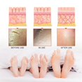 thumbnail image 3 of 1-6pcs JAYSUING Foot Peeling Spray 100ml Pedicure Dead Skin Exfoliator for Cracked Rough Heels, Remo, 3 of 5