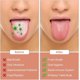 thumbnail image 3 of Raspador de lengua, 2 piezas de acero inoxidable, limpiador de lengua, raspador de lengua, elimina el mal aliento, aliento fresco (oro rosa), 3 of 5