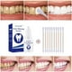 thumbnail image 5 of Fiudx Liquidación De Ahorros De Verano Blanqueamiento Higiene Limpieza Cuidado De Los Dientes Limpieza De Dientes Blanqueamiento 10Ml, 5 of 6