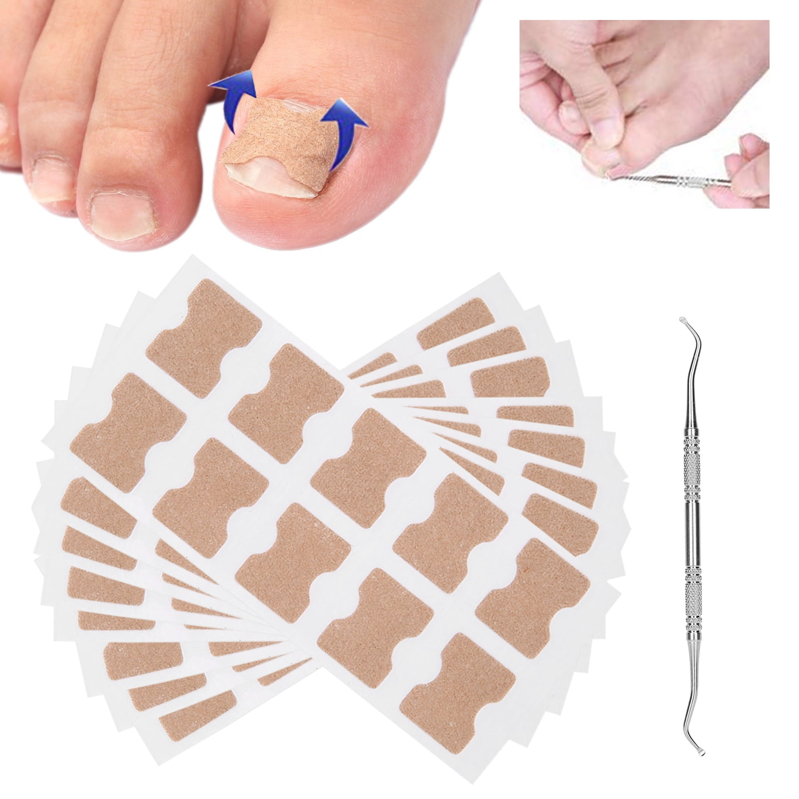 Mgaxyff Ingrown Toenail Patch, Safe Ingrown Toenail Correction Sticker, Hygienic Small Woman For Family Toenail Home