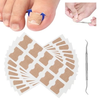 Manicure pedicure set for painless correction of ingrown nails - .  Gift Ideas