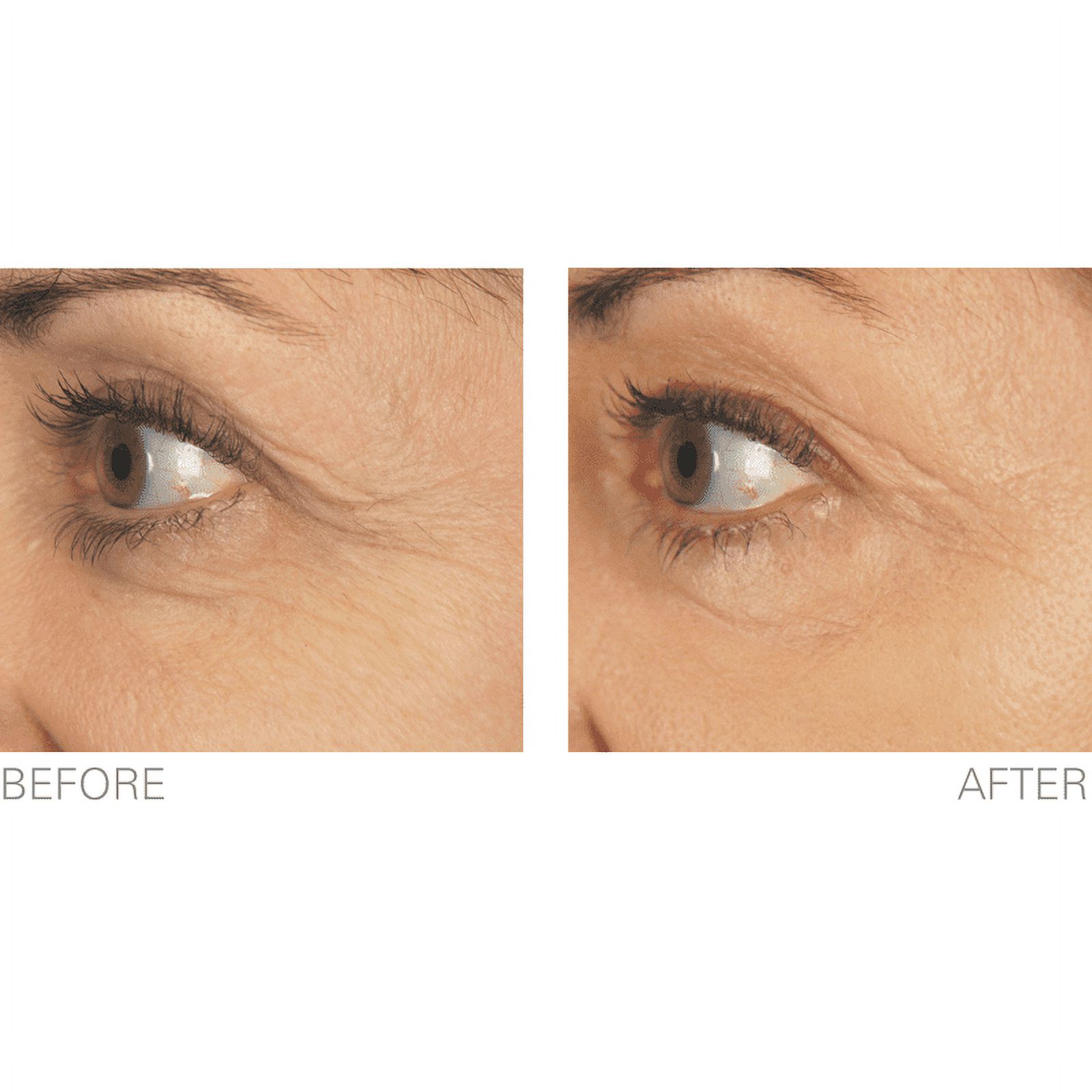 Stem Cell Therapy works to give you more youthful looking skin and reduce the appearance of wrinkles.