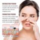 thumbnail image 3 of Sl Chang Jaysuing Blackhead Removal Nose Mask Deeply Cleans Blackheads And Pimples-, 3 of 4
