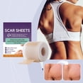 thumbnail image 2 of New Silicone Scar Patch Effectively Removes Scars And Reduces Marks Suitable For All Skin Types Continuous Use Restores Skin Health Xi-B07-0301-01, 2 of 7